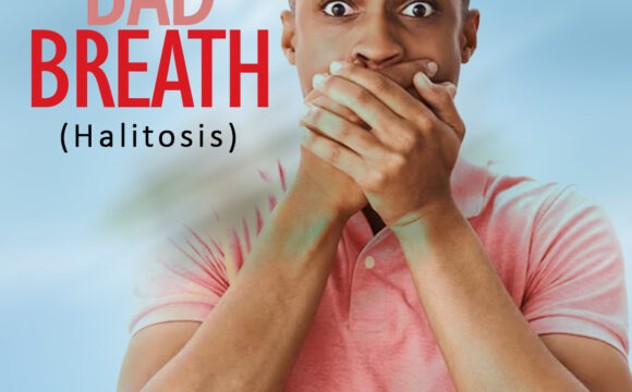 Bad breath – Halitosis