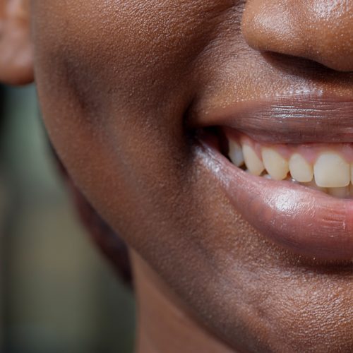Early Signs of Gum Disease Parents Shouldn’t Ignore