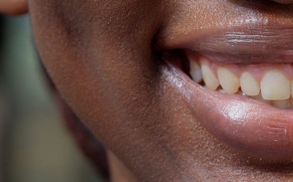 Early Signs of Gum Disease Parents Shouldn’t Ignore