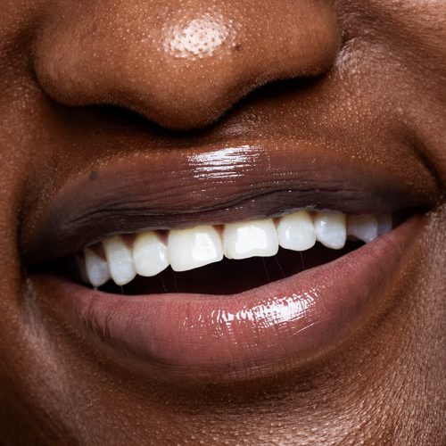 Best Cosmetic Dentistry Options for a Perfect Smile
