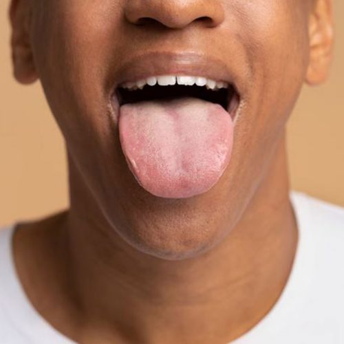 Oral Cancer Awareness: Risk Factors & Prevention