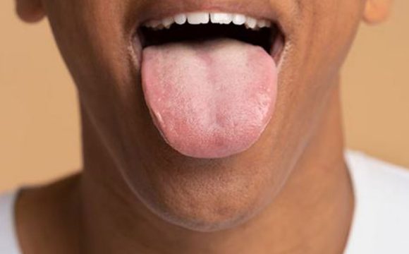 Oral Cancer Awareness: Risk Factors & Prevention