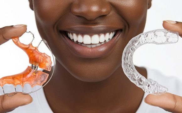 Retainers