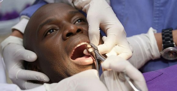 Tooth Extraction
