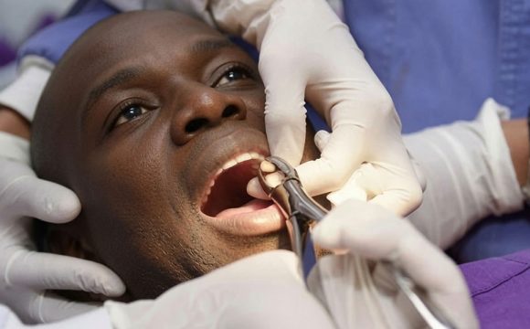 Tooth Extraction