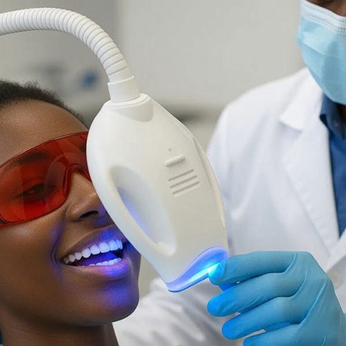Teeth Whitening