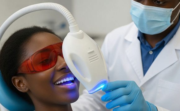 Teeth Whitening