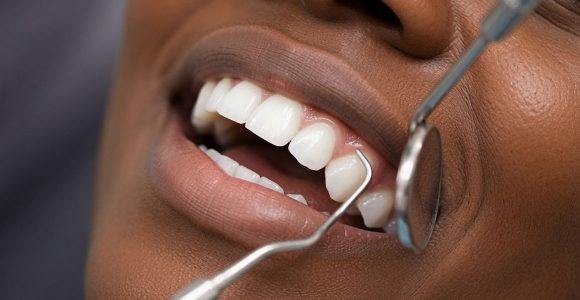 Dental Curettage