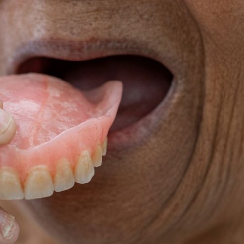 Dentures