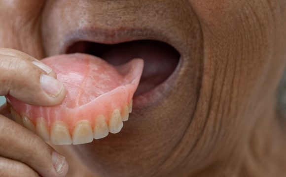 Dentures