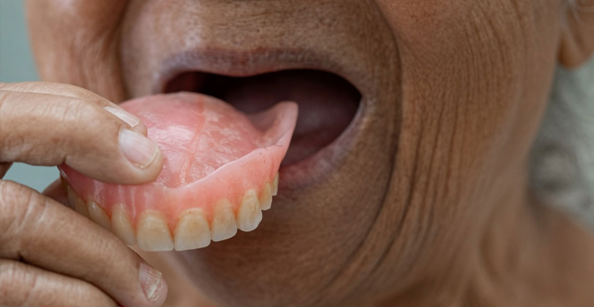 Hilton-Dental-dentures Dentures